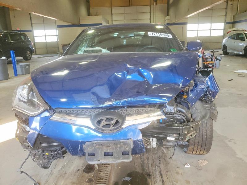 Photo 5 from auction – 2017 HYUNDAI VELOSTER with VIN KMHTC6AD3HU323645