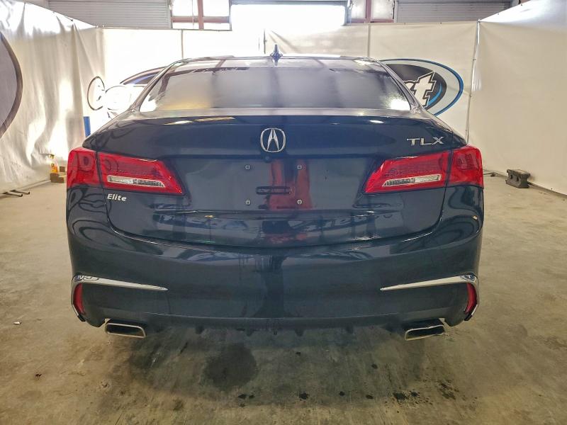 Photo 6 from auction – 2018 ACURA TLX TECH with VIN 19UUB2F58JA001811