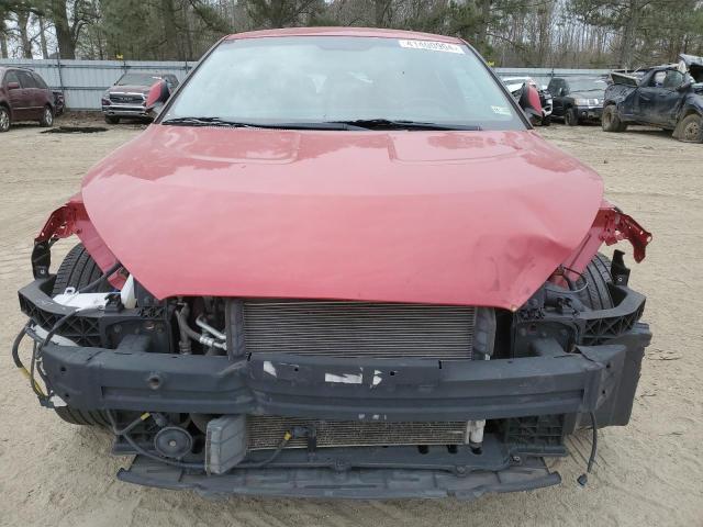 Photo 5 from auction – 2017 HYUNDAI VELOSTER with VIN KMHTC6AD4HU305638
