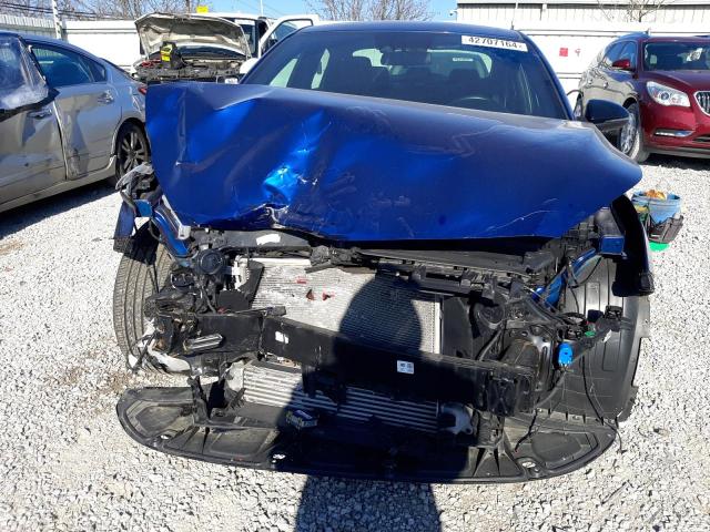 Photo 5 from auction – 2021 KIA FORTE GT with VIN 3KPF44AC8ME409004