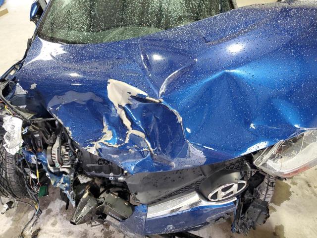 Photo 11 from auction – 2016 HYUNDAI VELOSTER with VIN KMHTC6ADXGU299570