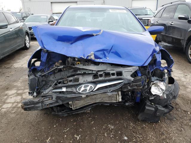 Photo 5 from auction – 2013 HYUNDAI ACCENT with VIN KMHCT4AE1DU495843
