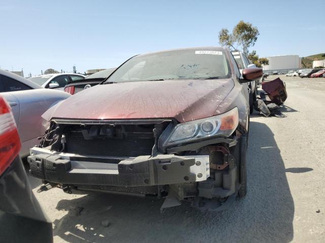 Photo 5 from auction – 2014 ACURA ILX 20 TEC with VIN 19VDE1F70EE003890