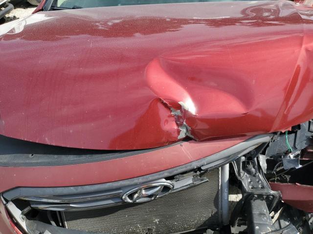 Photo 11 from auction – 2015 HYUNDAI SONATA SPO with VIN 5NPE34AF1FH075602