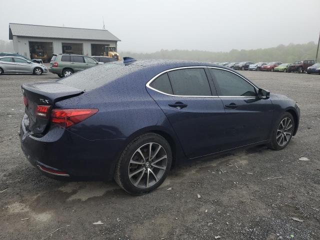 Photo 3 from auction – 2015 ACURA TLX ADVANC with VIN 19UUB2F72FA001523