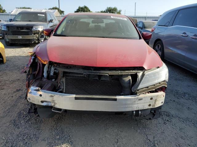 Photo 5 from auction – 2017 ACURA ILX BASE W with VIN 19UDE2F33HA003577