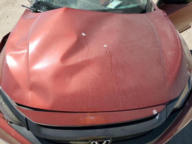 Photo 11 from auction – 2020 HONDA CIVIC EX with VIN 19XFC1F35LE001049