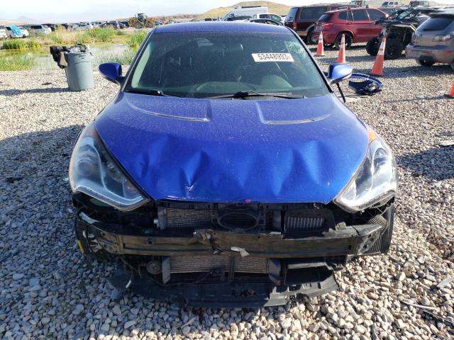 Photo 5 from auction – 2014 HYUNDAI VELOSTER T with VIN KMHTC6AE2EU198514