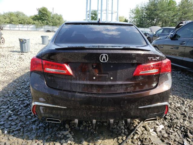 Photo 6 from auction – 2018 ACURA TLX TECH with VIN 19UUB2F58JA002926