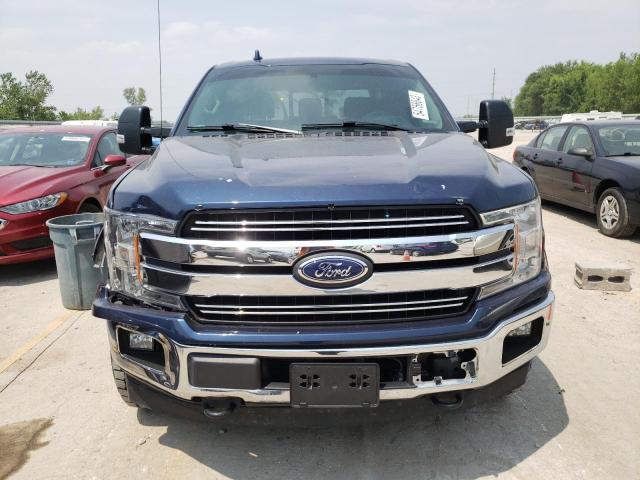 Photo 5 from auction – 2018 FORD F150 SUPER with VIN 1FTFW1EG0JFE10154