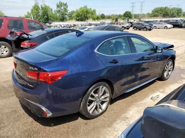 Photo 3 from auction – 2019 ACURA TLX TECHNO with VIN 19UUB3F47KA005928