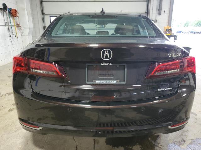 Photo 6 from auction – 2015 ACURA TLX ADVANC with VIN 19UUB3F76FA001319
