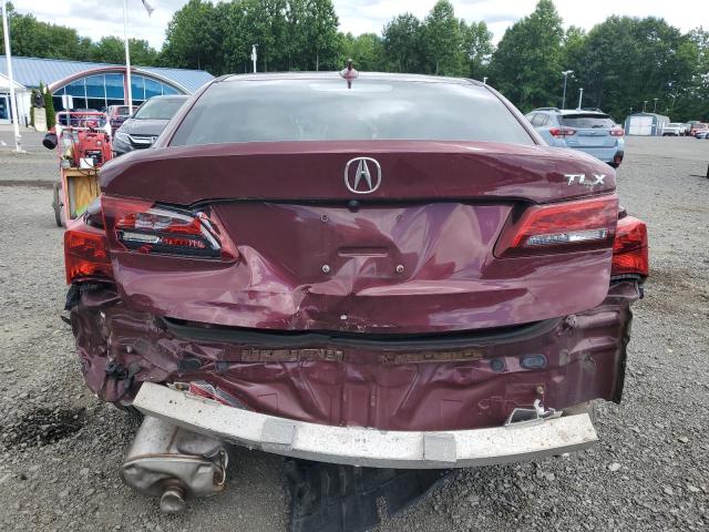 Photo 6 from auction – 2015 ACURA TLX with VIN 19UUB1F35FA026360