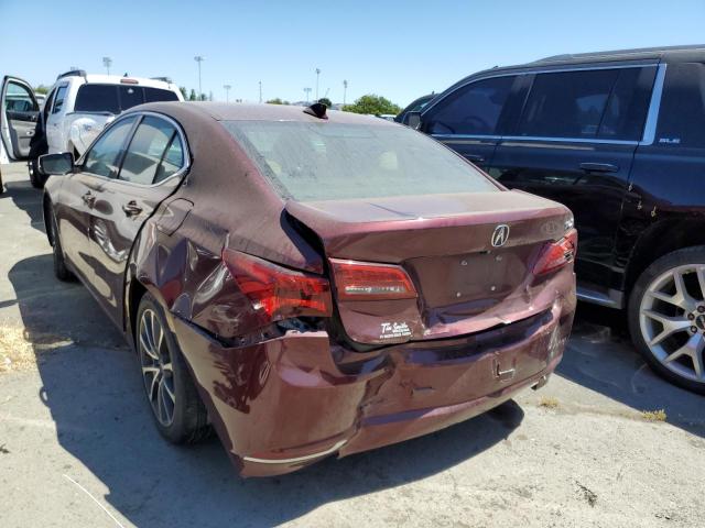 Photo 2 from auction – 2015 ACURA TLX with VIN 19UUB2F34FA015369