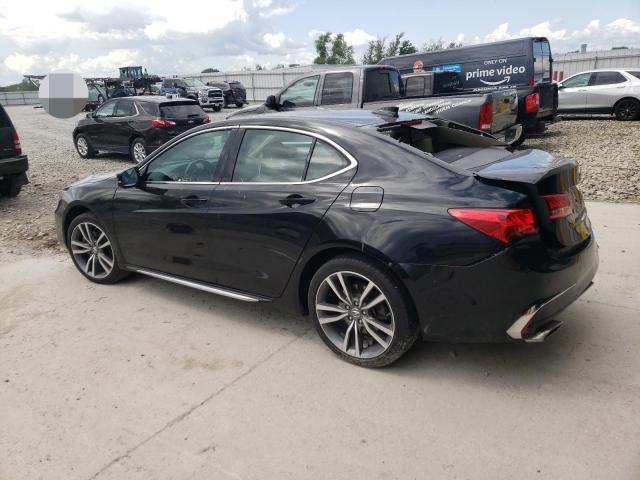 Photo 2 from auction – 2019 ACURA TLX TECHNO with VIN 19UUB2F48KA003406