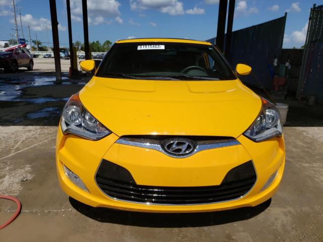 Photo 5 from auction – 2017 HYUNDAI VELOSTER with VIN KMHTC6AD7HU320747