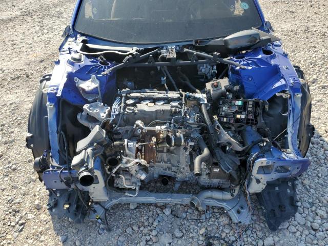 Photo 11 from auction – 2021 ACURA TLX TECH A with VIN 19UUB6F59MA005684