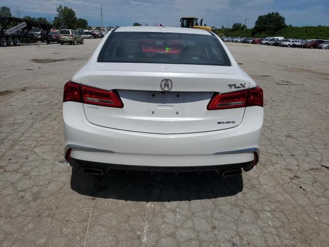 Photo 6 from auction – 2020 ACURA TLX TECHNO with VIN 19UUB3F40LA000507