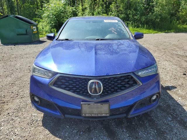 Photo 5 from auction – 2018 ACURA TLX TECH+A with VIN 19UUB3F6XJA802612