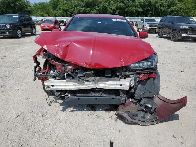 Photo 5 from auction – 2018 ACURA TLX TECH+A with VIN 19UUB2F62JA000694