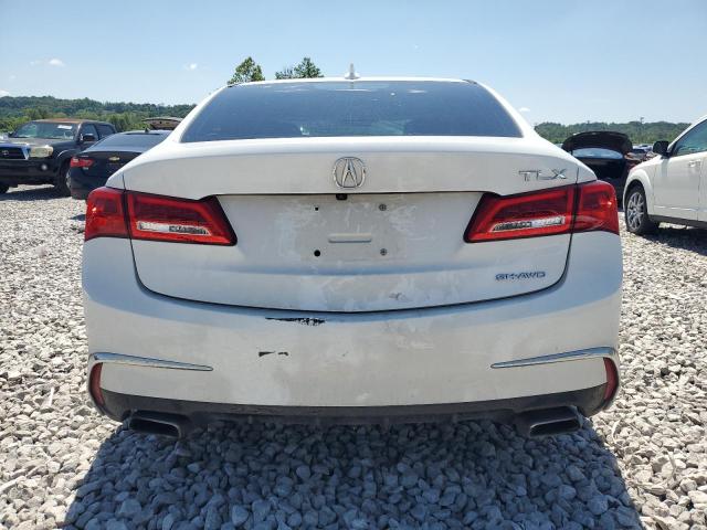 Photo 6 from auction – 2019 ACURA TLX TECHNO with VIN 19UUB3F40KA003518