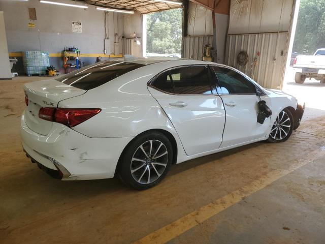 Photo 3 from auction – 2018 ACURA TLX with VIN 19UUB3F30JA000530