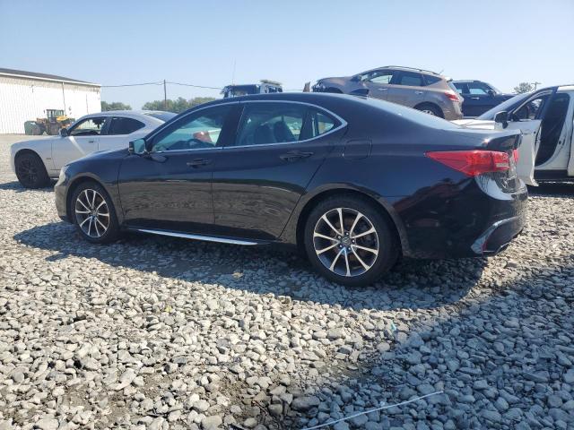 Photo 2 from auction – 2018 ACURA TLX TECH with VIN 19UUB2F5XJA012745