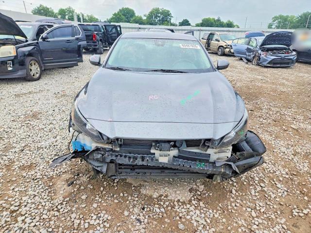 Photo 5 from auction – 2022 NISSAN ALTIMA with VIN 1N4BL4BVXNN329546