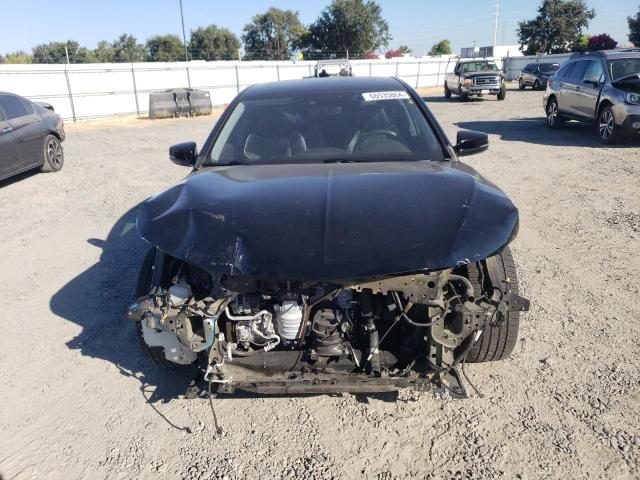 Photo 5 from auction – 2020 ACURA TLX TECHNO with VIN 19UUB2F43LA002861