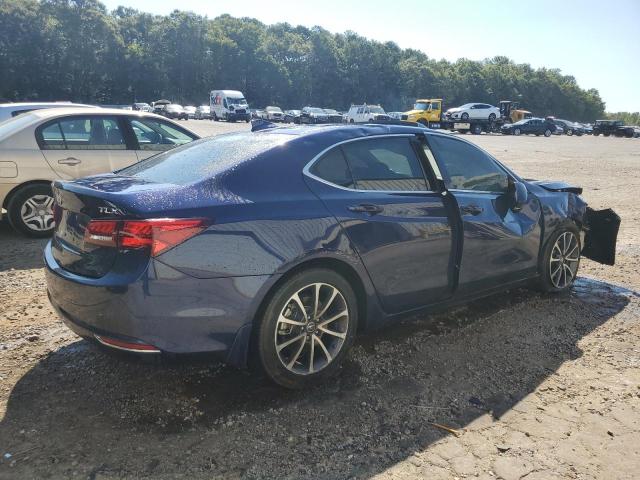 Photo 3 from auction – 2015 ACURA TLX TECH with VIN 19UUB1F57FA025132