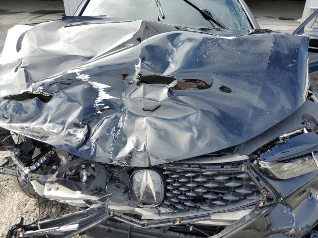 Photo 11 from auction – 2019 ACURA TLX TECHNO with VIN 19UUB2F68KA008459