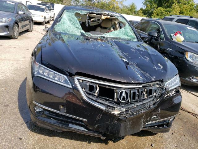 Photo 5 from auction – 2015 ACURA TLX TECH with VIN 19UUB2F56FA009218