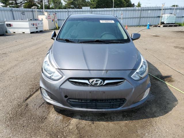 Photo 5 from auction – 2017 HYUNDAI ACCENT SE with VIN KMHCT4AE3HU184355