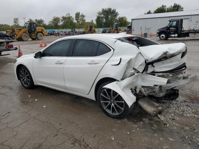 Photo 2 from auction – 2015 ACURA TLX with VIN 19UUB2F33FA005335