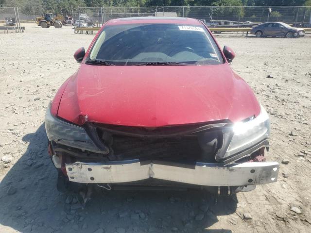 Photo 5 from auction – 2017 ACURA ILX BASE W with VIN 19UDE2F33HA009086