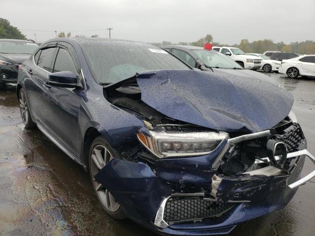 Photo 4 from auction – 2019 ACURA TLX TECHNO with VIN 19UUB3F49KA005932