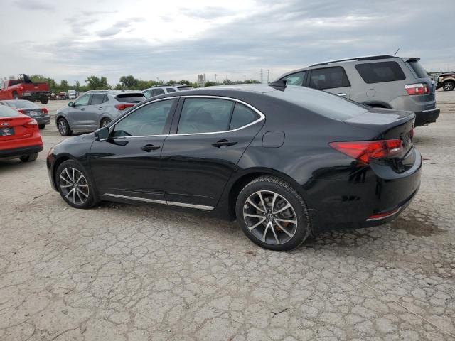 Photo 2 from auction – 2017 ACURA TLX TECH with VIN 19UUB3F53HA002851