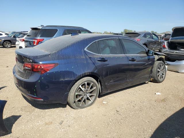 Photo 3 from auction – 2015 ACURA TLX TECH with VIN 19UUB2F57FA000978