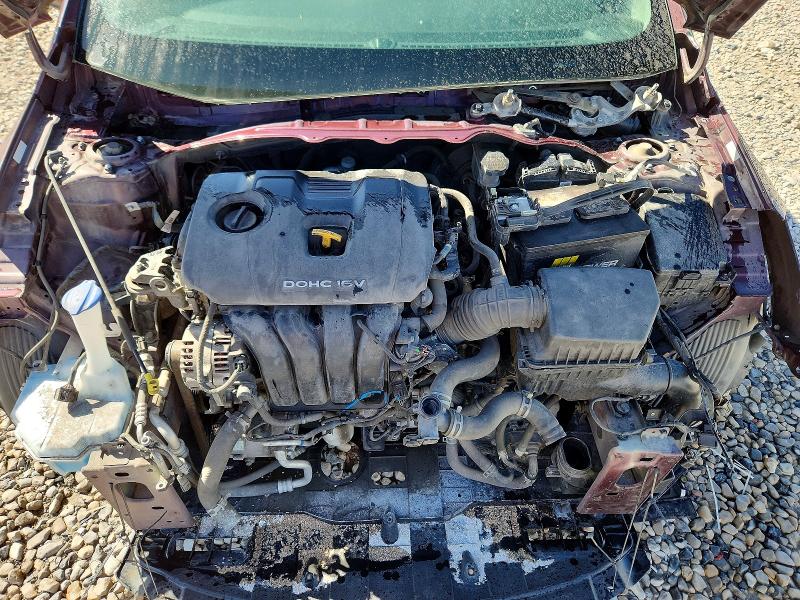 Photo 11 from auction – 2018 KIA FORTE with VIN 3KPFK4A79JE178733