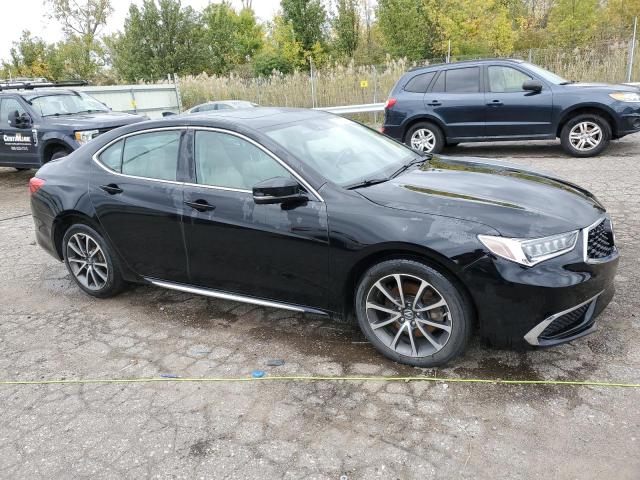 Photo 4 from auction – 2018 ACURA TLX TECH with VIN 19UUB3F53JA001835