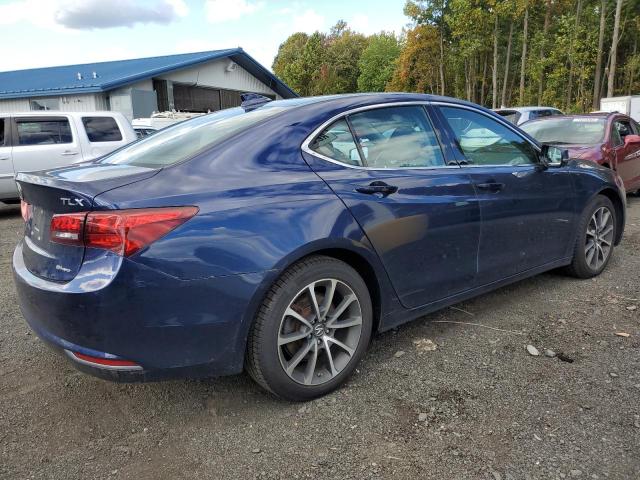 Photo 3 from auction – 2015 ACURA TLX TECH with VIN 19UUB3F53FA010333
