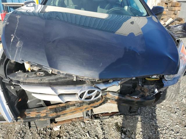 Photo 11 from auction – 2013 HYUNDAI SONATA GLS with VIN 5NPEB4AC3DH723317