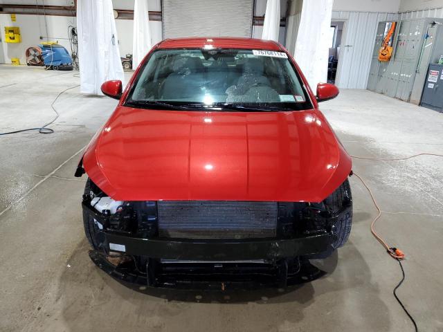 Photo 5 from auction – 2020 HYUNDAI ELANTRA SE with VIN 5NPD74LF3LH525923