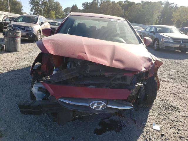 Photo 5 from auction – 2017 HYUNDAI ACCENT SE with VIN KMHCT4AE7HU333625