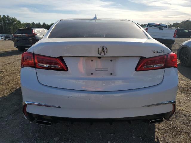 Photo 6 from auction – 2018 ACURA TLX with VIN 19UUB2F36JA001000
