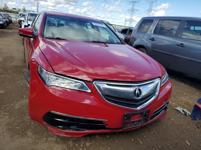 Photo 5 from auction – 2017 ACURA TLX TECH with VIN 19UUB2F56HA001705