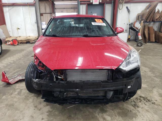 Photo 5 from auction – 2017 HYUNDAI VELOSTER with VIN KMHTC6AD4HU306174