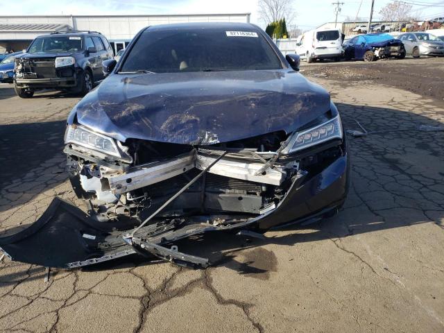 Photo 5 from auction – 2017 ACURA TLX TECH with VIN 19UUB1F58HA003529
