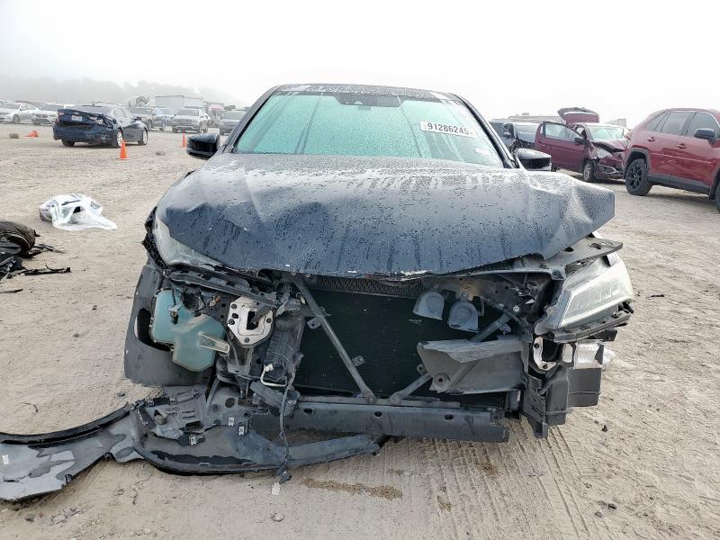 Photo 5 from auction – 2015 ACURA TLX TECH with VIN 19UUB1F54FA023967
