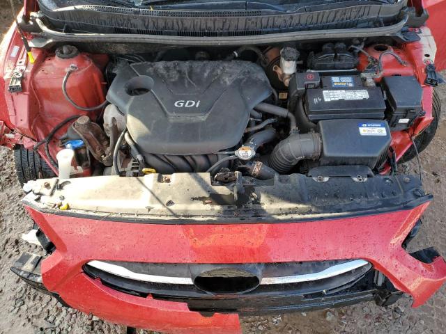 Photo 11 from auction – 2017 HYUNDAI ACCENT SE with VIN KMHCT4AE2HU271762
